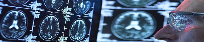 神經(jīng)干細胞移植的過程