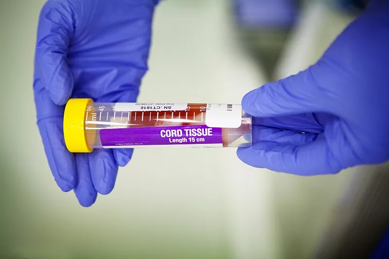 間充質干細胞的優點有哪些？