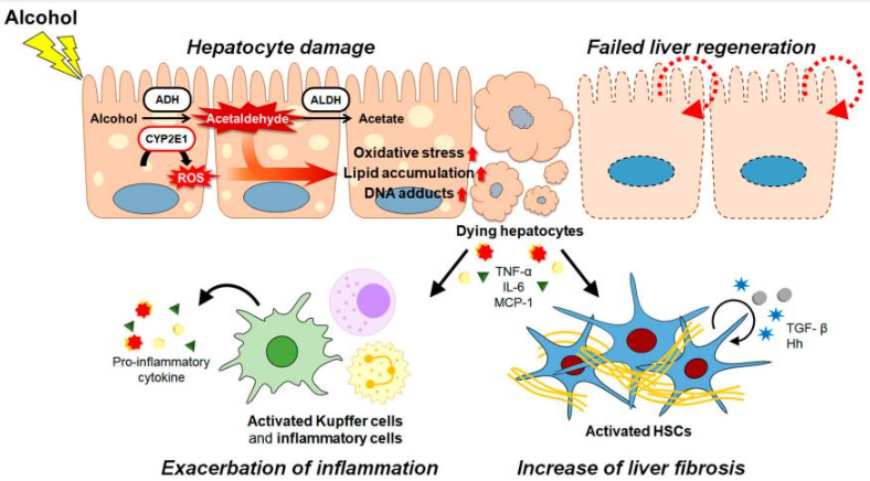 酒精及其代謝物通過各種途徑和/或機制共同促進ALD的發病機制。（如圖1）