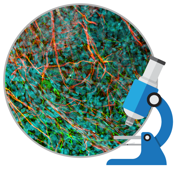 干細胞治療如何對自閉癥患者提供幫助?