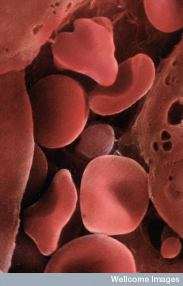 許多血液疾病已經可以使用臍帶血進行治療。