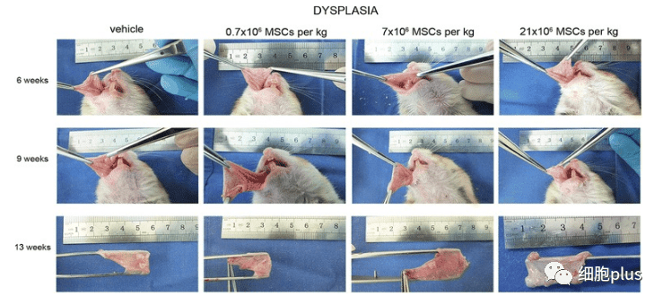 在腫瘤增生期，全身注射同種異體間充質(zhì)干細(xì)胞不會(huì)加速癌前病變的進(jìn)展。