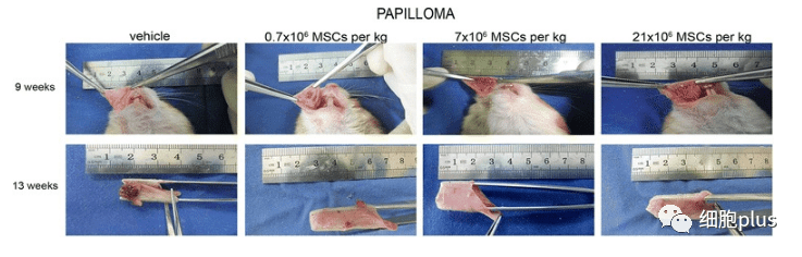 在非典型增生期，全身注射同種異體間充質(zhì)干細(xì)胞不會(huì)加速癌前病變的進(jìn)展。