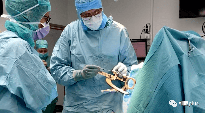 諾和諾德資助,瑞典完成首例干細(xì)胞衍生神經(jīng)細(xì)胞定向移植治療帕金森癥