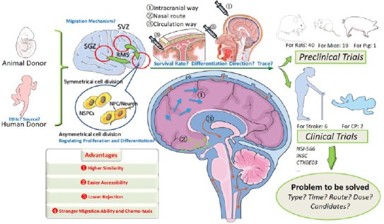 神經干細胞移植治療中風的臨床試驗的步驟和挑戰