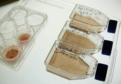 用生長因子培養的胚胎和誘導多能 (iPS) 干細胞變得有色素(棕色)并顯示出視網膜色素上皮細胞的特征