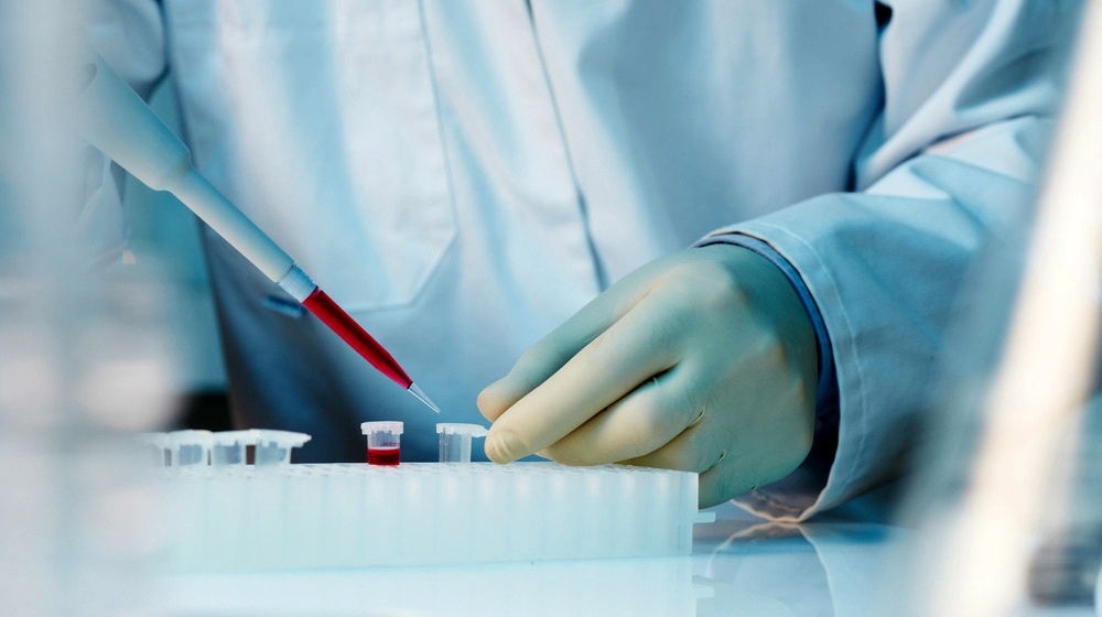 什么是干細(xì)胞移植-干細(xì)胞移植的流程和優(yōu)勢(shì) 什么是干細(xì)胞移植-干細(xì)胞移植的流程和優(yōu)勢(shì)