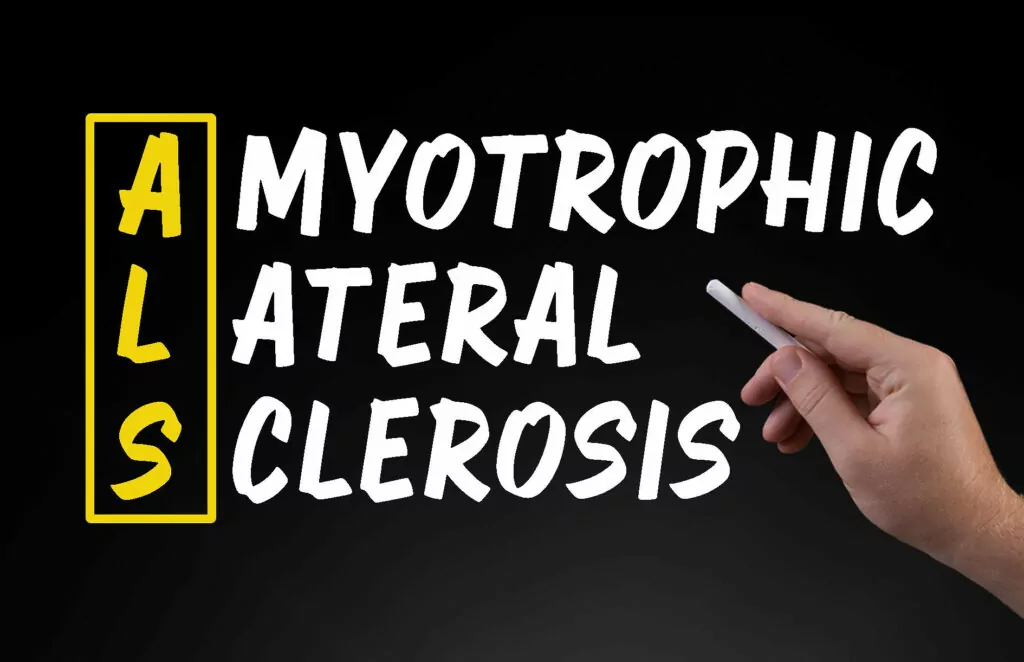 干細胞治療背景下的肌萎縮側索硬化癥 干細胞治療背景下的肌萎縮側索硬化癥