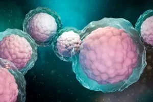 干細胞治療糖尿病 干細胞治療糖尿病