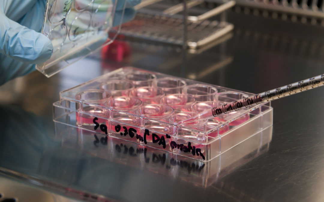 踝關節疼痛的干細胞療法 踝關節疼痛的干細胞療法