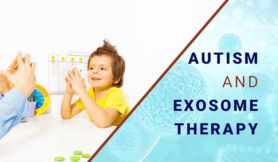 干細胞外泌體治療自閉癥 干細胞外泌體治療自閉癥