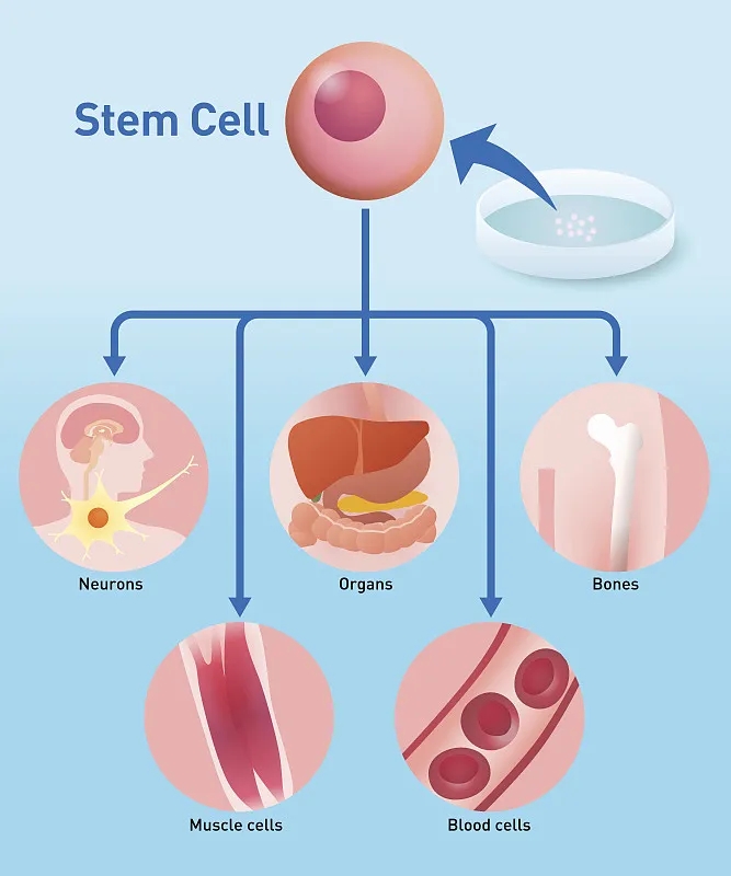 自體干細胞移植：工作原理、益處和風險
