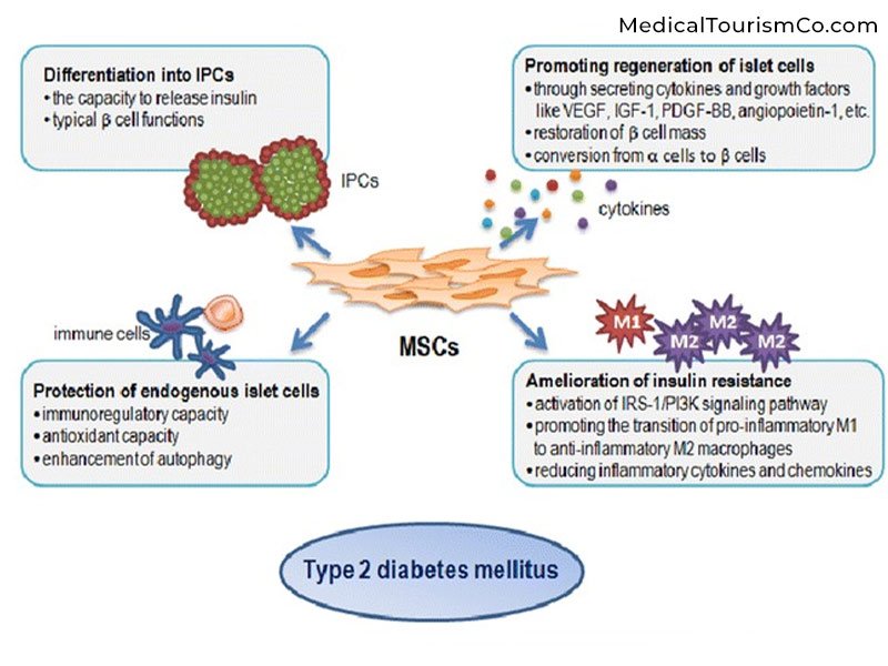 為什么干細胞治療2型糖尿病? 為什么干細胞治療2型糖尿病?