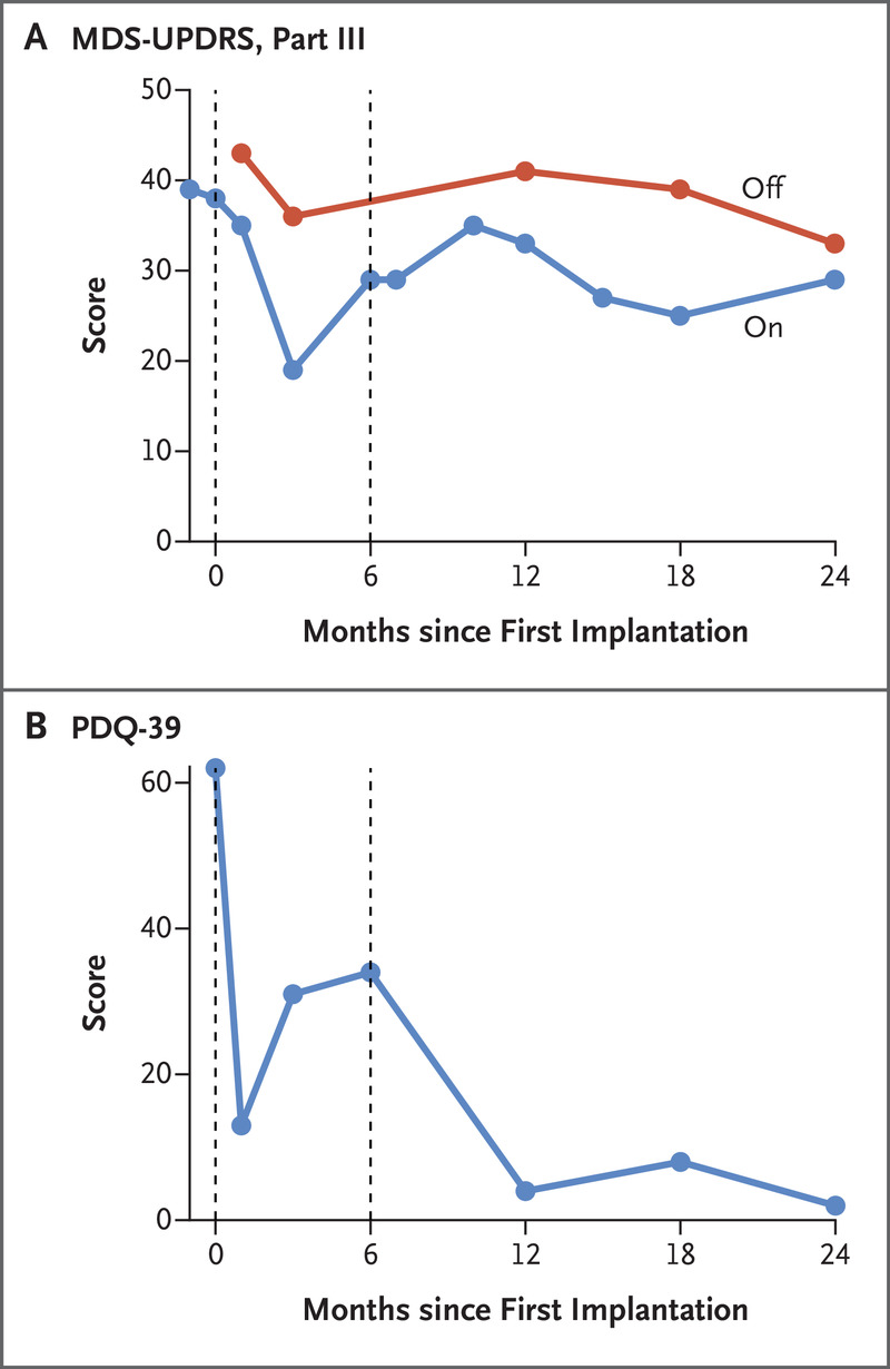 圖 3.帕金森病相關運動能力和生活質量的橫向臨床評估。 圖3.帕金森病相關運動能力和生活質量的橫向臨床評估。