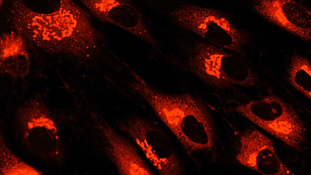間充質(zhì)干細胞衍生療法和外泌體作為先進療法的后起之秀