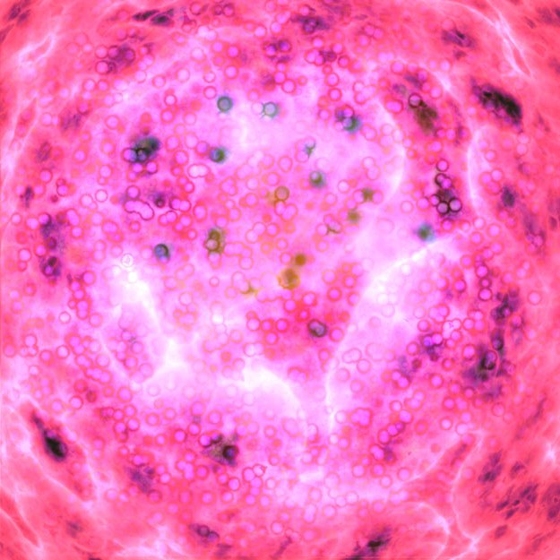 干細(xì)胞簡介| 帕金森病的干細(xì)胞治療 干細(xì)胞簡介| 帕金森病的干細(xì)胞治療