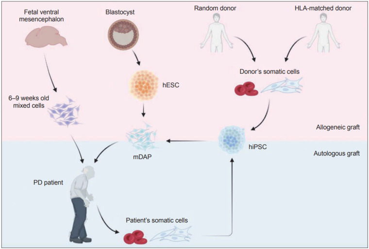 圖1:帕金森病 (PD) 細胞替代療法的潛在細胞來源比較。 圖1:帕金森病 (PD) 細胞替代療法的潛在細胞來源比較。