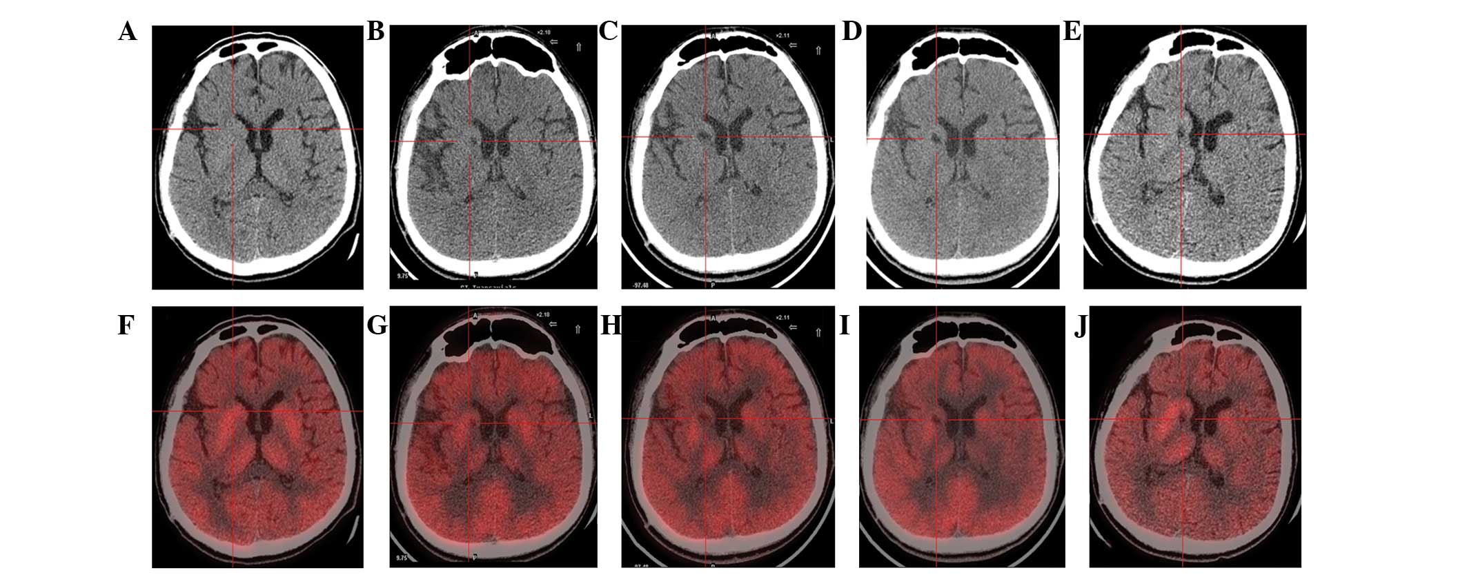 圖1：計算機斷層掃描 (CT) 和正電子發(fā)射斷層掃描 (PET) 掃描。