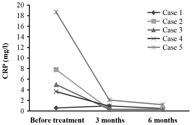 圖4:每位患者治療前后的CRP水平。1名患者的CRP水平降低,而其他4名患者的CRP水平保持穩(wěn)定并在正常范圍內(nèi)。 圖4:每位患者治療前后的CRP水平。1名患者的CRP水平降低,而其他4名患者的CRP水平保持穩(wěn)定并在正常范圍內(nèi)。