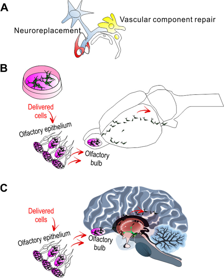 圖1：干細(xì)胞移植治療帕金森病的示意圖。