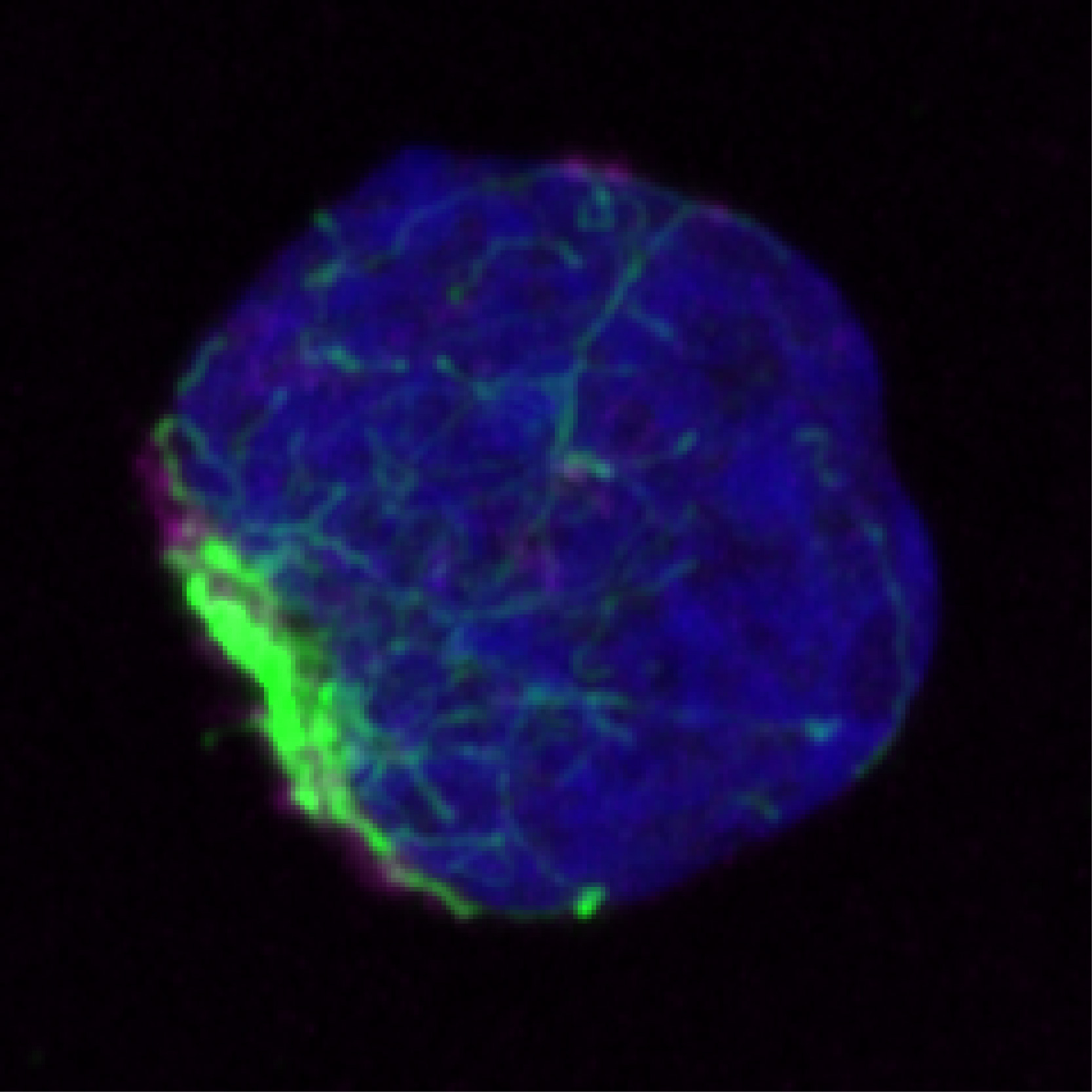加州大學(xué)圣地亞哥分校的科學(xué)家發(fā)現(xiàn)，錯(cuò)誤折疊的蛋白質(zhì)在被處理之前聚集并被限制在干細(xì)胞內(nèi)的單個(gè)區(qū)域（綠色）中。