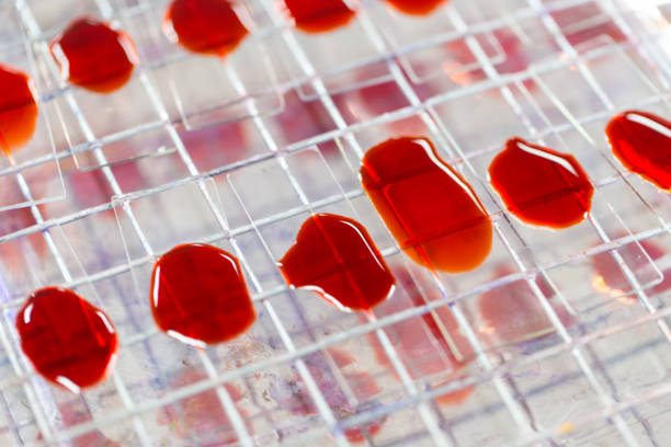 可以用臍帶血干細胞可以治療哪些疾病? 可以用臍帶血干細胞可以治療哪些疾病?