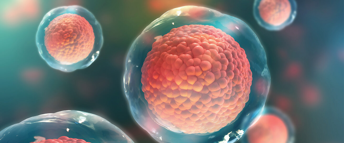 干細胞技術有助于確定精神分裂癥的潛在因果機制