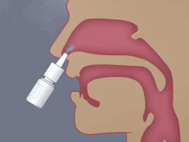 日本居家干細胞噴鼻能治療腦梗死：是科學突破還是商業噱頭？