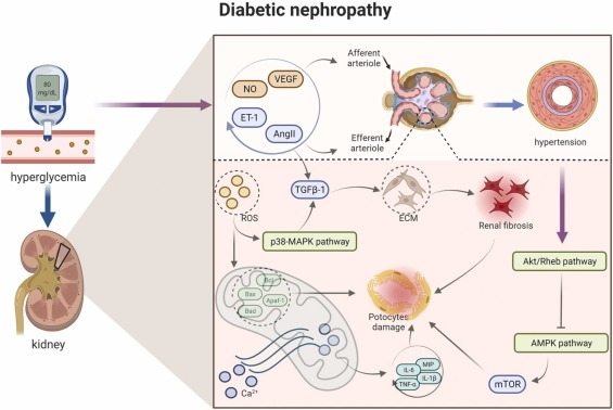 圖1：糖尿病腎病的病理信號(hào)。