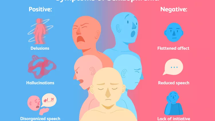 精神分裂癥的類型有哪些? 精神分裂癥的類型有哪些?