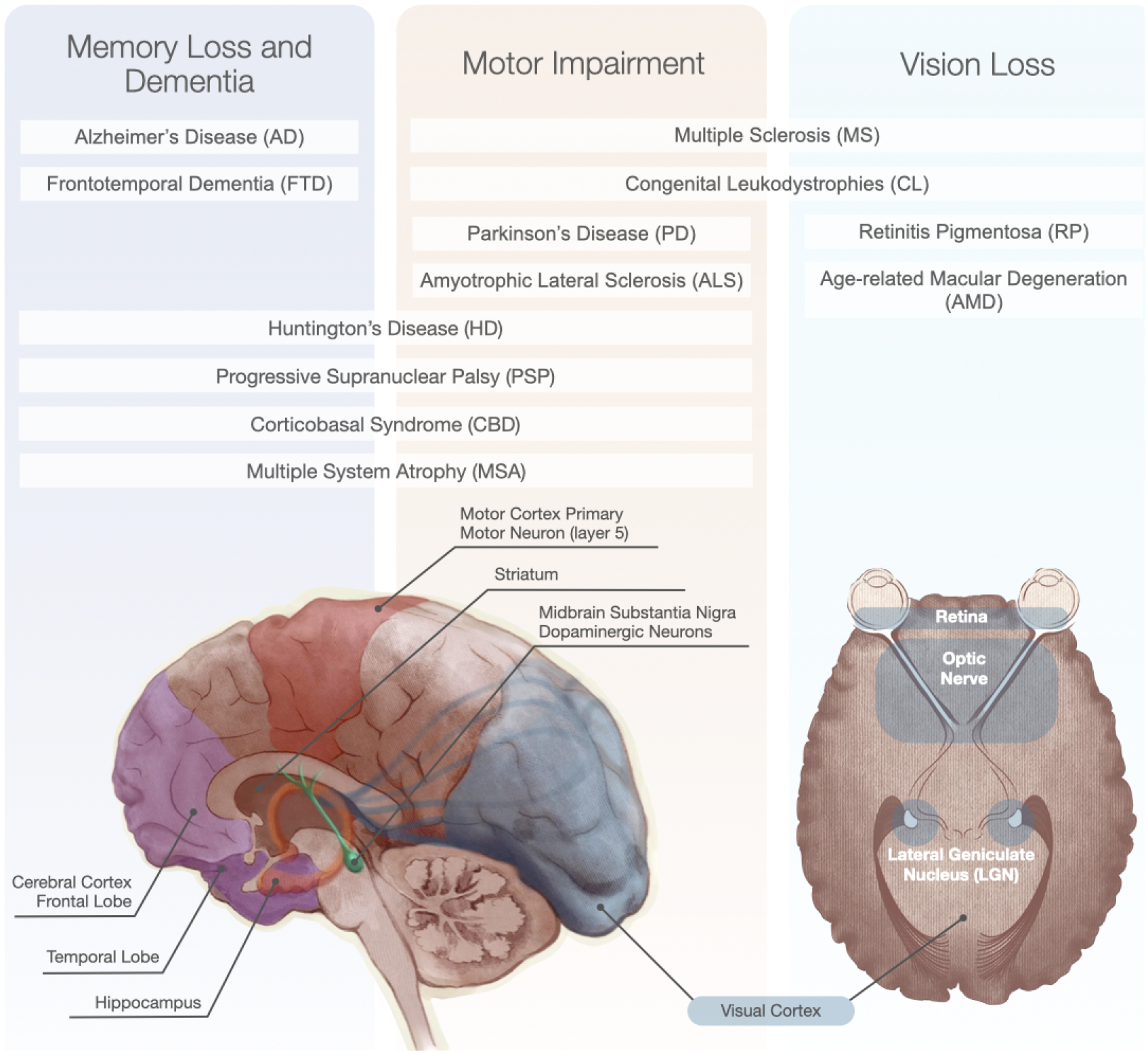 圖1:神經(jīng)退行性疾病和受影響的大腦區(qū)域的主要功能影響。 圖1:神經(jīng)退行性疾病和受影響的大腦區(qū)域的主要功能影響。