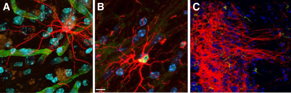 圖3:人類中樞神經(jīng)系統(tǒng)干細(xì)胞 (HuCNS-SC) 根據(jù)其遷移位點(diǎn)優(yōu)先分化為特定譜系。 圖3:人類中樞神經(jīng)系統(tǒng)干細(xì)胞 (HuCNS-SC) 根據(jù)其遷移位點(diǎn)優(yōu)先分化為特定譜系。