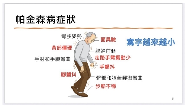 帕金森病癥狀