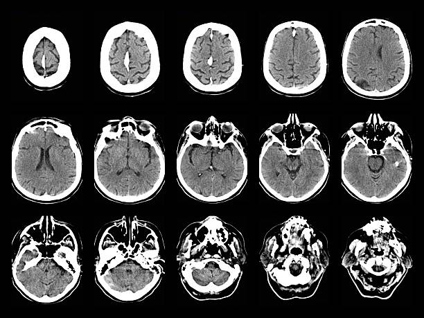 老年神經系統會出現哪些問題? 老年神經系統會出現哪些問題?