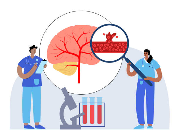 圍產(chǎn)期中風(fēng)-類型、原因和風(fēng)險(xiǎn)因素 圍產(chǎn)期中風(fēng)-類型、原因和風(fēng)險(xiǎn)因素