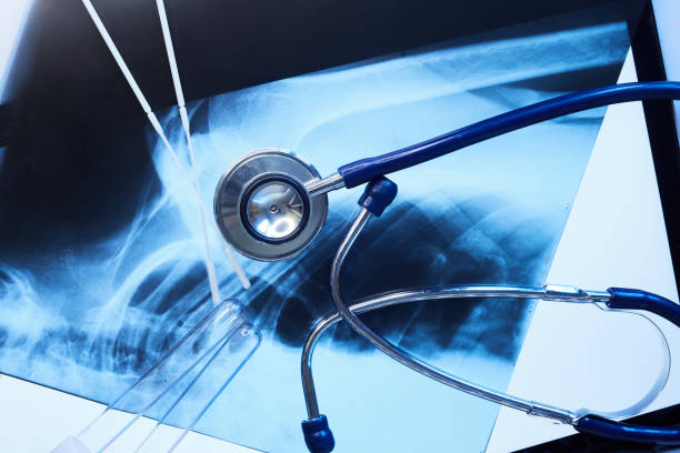 干細胞治療在風濕病中的作用 干細胞治療在風濕病中的作用