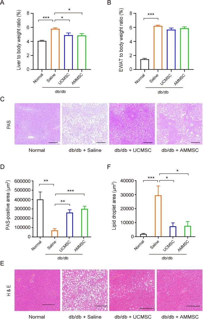 圖2:MSC給藥減少了小鼠肝臟中的脂質積累并增加了糖原儲存 圖2:MSC給藥減少了小鼠肝臟中的脂質積累并增加了糖原儲存