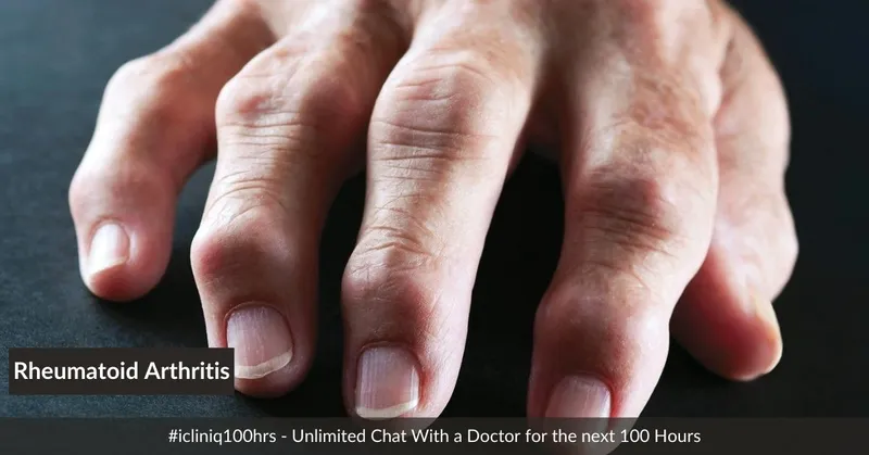 類風濕關節炎的體征和癥狀是什么?及其治療方法 類風濕關節炎的體征和癥狀是什么?及其治療方法