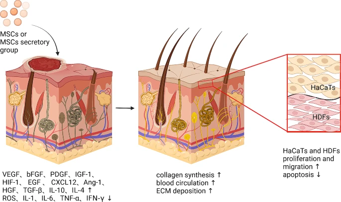 圖5:間充質干細胞促進皮膚創面愈合的機制。 圖5:間充質干細胞促進皮膚創面愈合的機制。