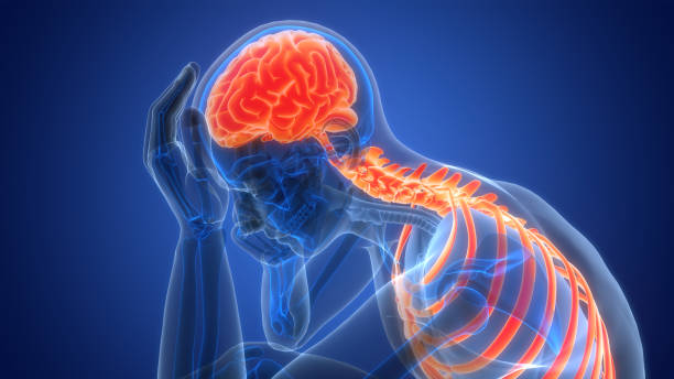 什么是缺血性腦中風(fēng)，癥狀、原因、診斷和治療