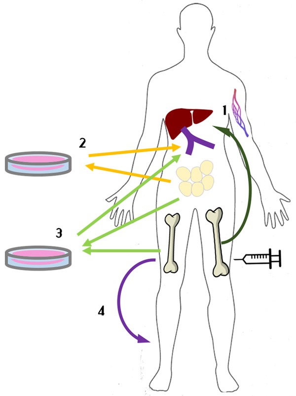 圖1：間充質干細胞治療1型糖尿病方法示意圖。