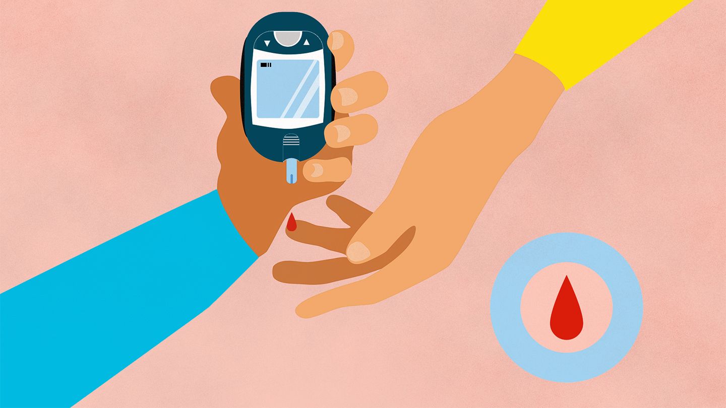 干細(xì)胞治療糖尿病的效果如何呢?有臨床研究成果嗎? 干細(xì)胞治療糖尿病的效果如何呢?有臨床研究成果嗎?