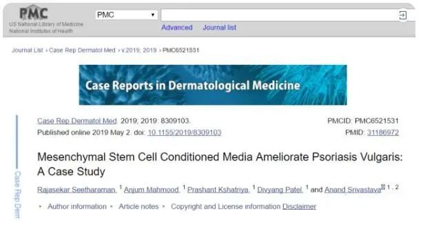 2019年干細胞治療銀屑病臨床案例 2019年干細胞治療銀屑病臨床案例