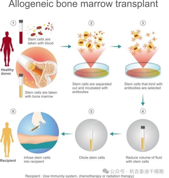 干細(xì)胞移植治療需要多長(zhǎng)時(shí)間？