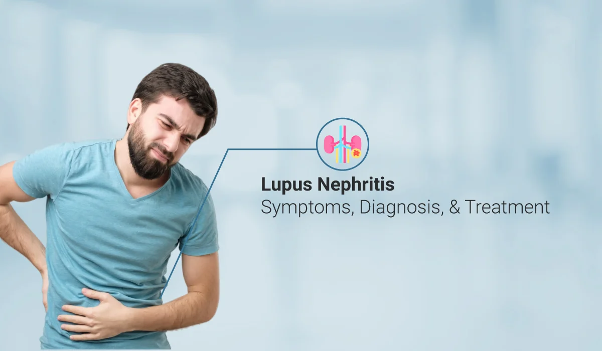 狼瘡性腎炎癥狀與發(fā)病原因 狼瘡性腎炎癥狀與發(fā)病原因