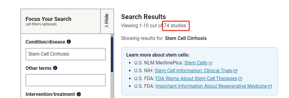 干細胞治療肝硬化的臨床研究進展 干細胞治療肝硬化的臨床研究進展