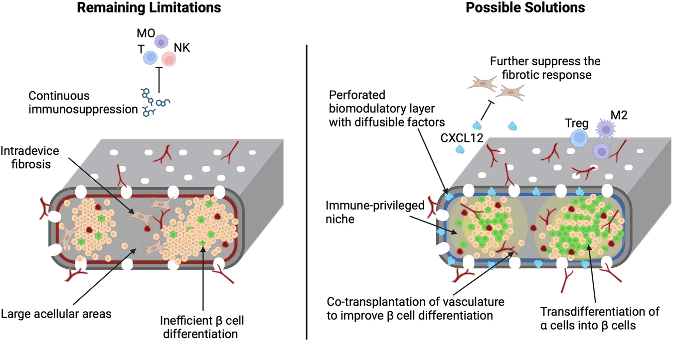 圖2:增加功能性β細胞質(zhì)量和消除全身免疫抑制的策略 圖2:增加功能性β細胞質(zhì)量和消除全身免疫抑制的策略