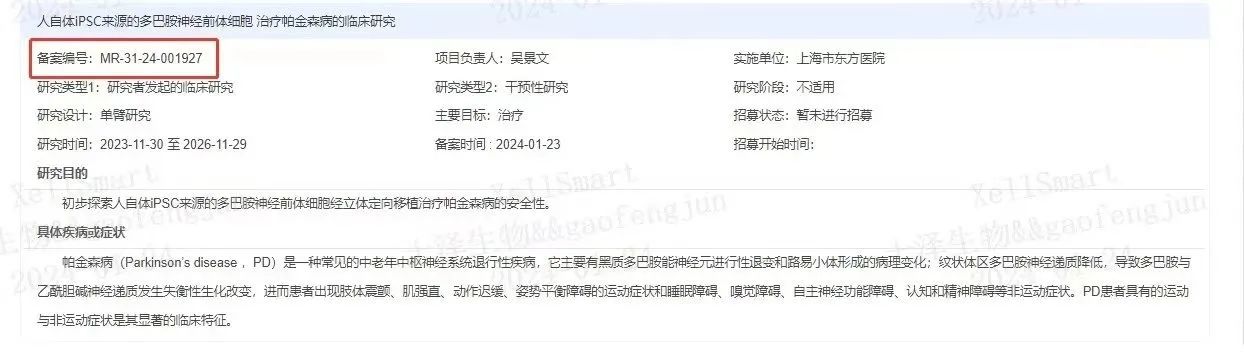 臨床級(jí)iPSC衍生多巴胺能神經(jīng)前體細(xì)胞治療帕金森病的臨床研究 臨床級(jí)iPSC衍生多巴胺能神經(jīng)前體細(xì)胞治療帕金森病的臨床研究