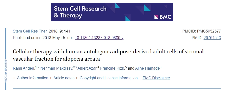 使用人類自體脂肪基質(zhì)血管成分成體細(xì)胞治療斑禿的臨床研究綜述 使用人類自體脂肪基質(zhì)血管成分成體細(xì)胞治療斑禿的臨床研究綜述