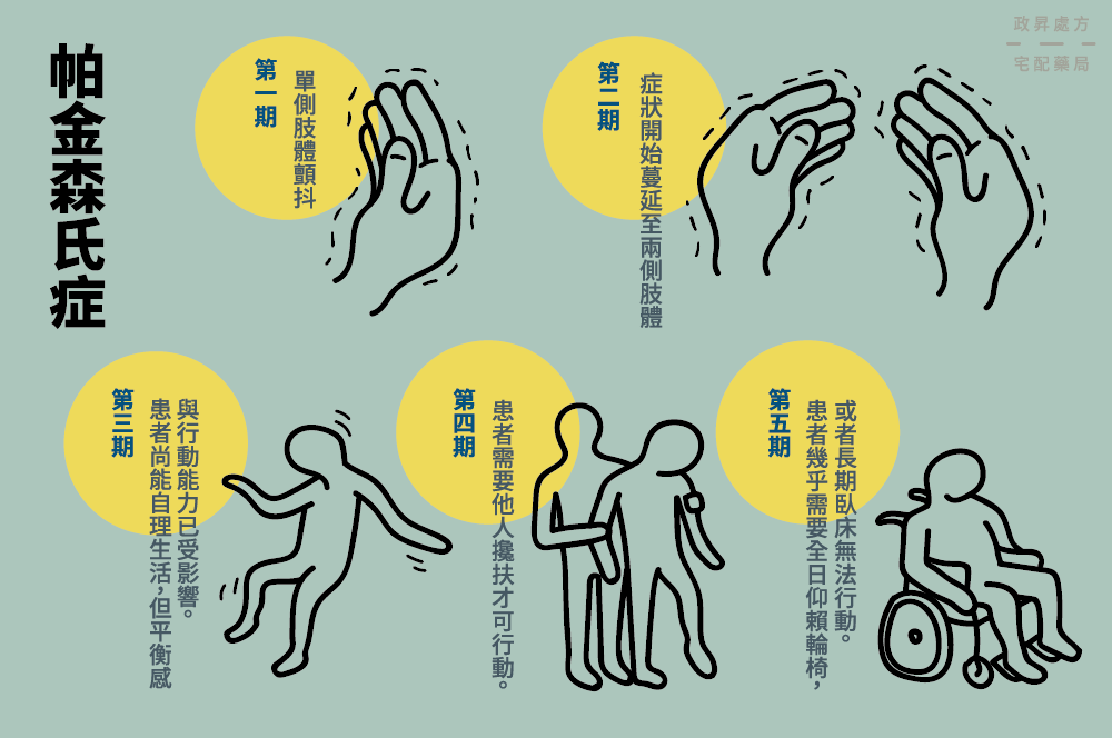 帕金森病的5個階段
